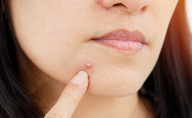 Exfoliate regularly for clearer skin and to reduce pimples