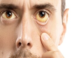 Vitamin B12 की कमी शरीर को करने लगती है खोखला, नजर आने लगें ये 5 लक्षण तो हो संभल जाए तुरंत  Vitamin B12 की कमी शरीर को करने लगती है खोखला, नजर आने लगें ये 5 लक्षण तो हो संभल जाए तुरंत