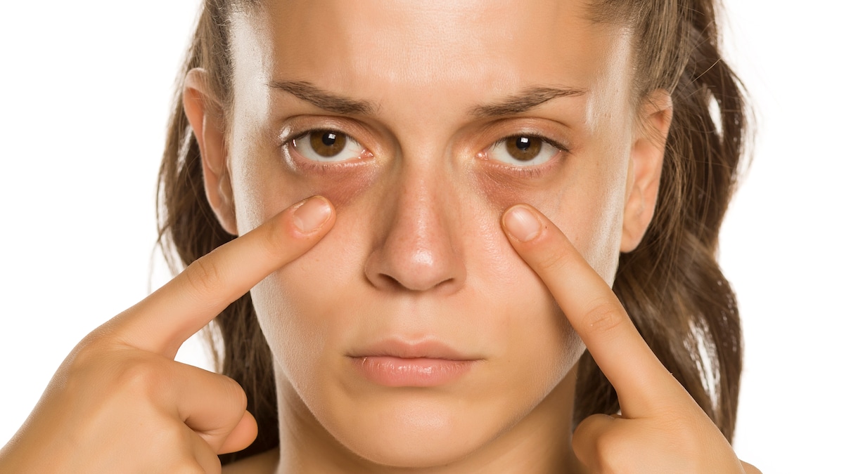 आंख की सूजन, गड्ढे और कालेपन को कम कर सकती हैं ये सब्जी, रामबाण घरेलू