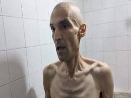 Photos Of Iranian Prisoner On Hunger Strike Cause Outrage Photos Of Iranian Prisoner On Hunger Strike Cause Outrage