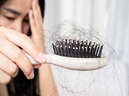 भयानक तरीके से बालों को गिरा देती है इस विटामिन की कमी, जानें Hair Fall रोकने के रामबाण घरेलू नुस्खे भयानक तरीके से बालों को गिरा देती है इस विटामिन की कमी, जानें Hair Fall रोकने के रामबाण घरेलू नुस्खे