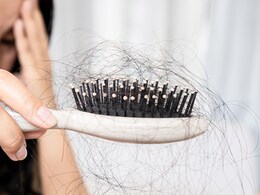 Losing Hair While On A Diet? Here's Where You Could Be Going Wrong Losing Hair While On A Diet? Here's Where You Could Be Going Wrong