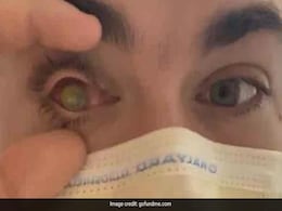 Man Sleeps With Contact Lenses On, Flesh-Eating Parasites Eat His Eye Man Sleeps With Contact Lenses On, Flesh-Eating Parasites Eat His Eye