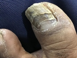 क्या आपके नाखून बहुत जल्दी जाते हैं टूट तो शरीर में हो गई इस विटामिन की कमी