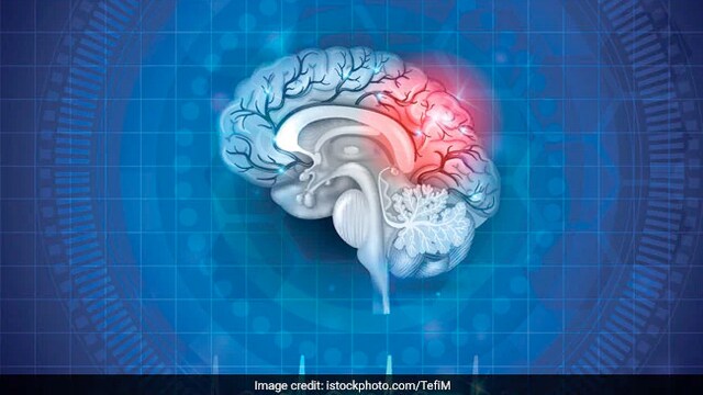 World Alzheimer's Day is observed on September 21 every year