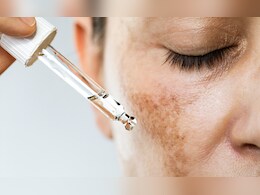 क्या चेहरे पर रोज नारियल तेल लगाना स्किन के लिए अच्छा होता है, जानिए यहां