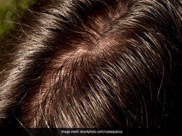 चिपचिपे बालों पर बस ये 2 चीजें देख लीजिए लगाकर, लहराने लगेंगे बाल और दिखेंगे बेहद खूबसूरत चिपचिपे बालों पर बस ये 2 चीजें देख लीजिए लगाकर, लहराने लगेंगे बाल और दिखेंगे बेहद खूबसूरत