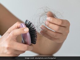 कंघी करते ही हाथ में आ जाता है बालों का गुच्छा तो किचन में मौजूद इस मसाले का ऐसे करें सेवन, कंट्रोल होगा-Hairfall कंघी करते ही हाथ में आ जाता है बालों का गुच्छा तो किचन में मौजूद इस मसाले का ऐसे करें सेवन, कंट्रोल होगा-Hairfall