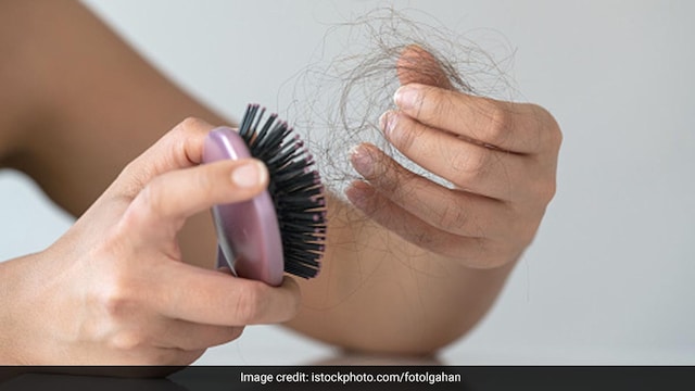 Nutritional deficiencies can cause severe hair fall