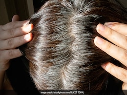 White hair को करना है काला तो अप्लाई करिए बारह मासी इस फूल का पेस्ट, नेचुरल ब्लैक हो जाएंगे बाल White hair को करना है काला तो अप्लाई करिए बारह मासी इस फूल का पेस्ट, नेचुरल ब्लैक हो जाएंगे बाल
