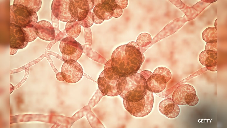 Fungal Disease Awareness Week: जानें क्या है फंगल डिजीज के लक्षण, कैसे पहचानें इंफेक्शन हुआ है?