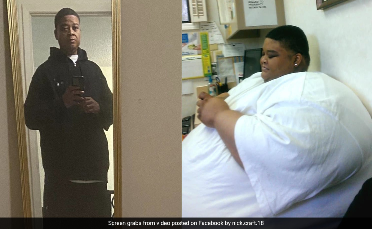 US Man Loses 165 Kg After Doctor Said He Was A “Ticking Time Bomb”