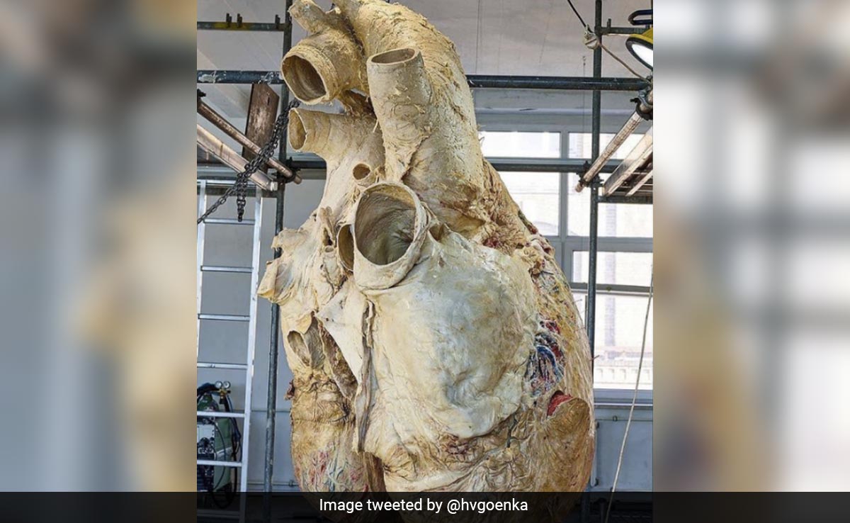 Harsh Goenka Shares Incredible Picture Of Blue Whale's Heart, Internet Fascinated