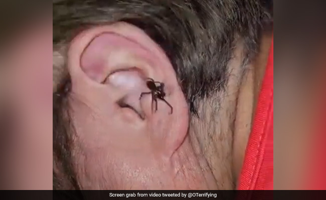 Watch: Old Video Shows Spider Crawling Out Of Man's Ear, Internet Shocked