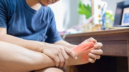 Managing Uric Acid Levels: The 5 Foods You Should Skip