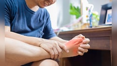 Uric Acid बढ़ा होने पर कैसी होनी चाहिए आपकी डाइट, जानिए पूरा Diet Chart क्या खाना है और क्या नहीं