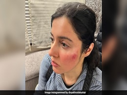 Divya Khosla Kumar "Badly Injured" While Filming, Shares Pic Of Bruised Face Divya Khosla Kumar "Badly Injured" While Filming, Shares Pic Of Bruised Face