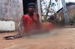 Child Dies Allegedly From Malnutrition In Odisha Child Dies Allegedly From Malnutrition In Odisha