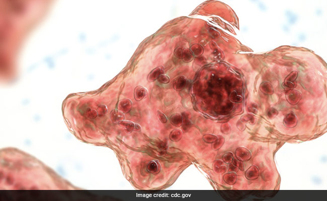 Naegleria Fowleri Kills US Man: All You Need To Know About 'Brain-Eating Amoeba'