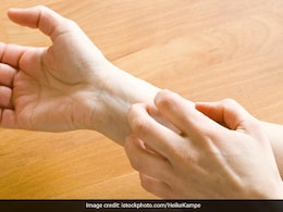 शरीर में किसी विटामिन की कमी से स्किन एलर्जी होने लगती है?