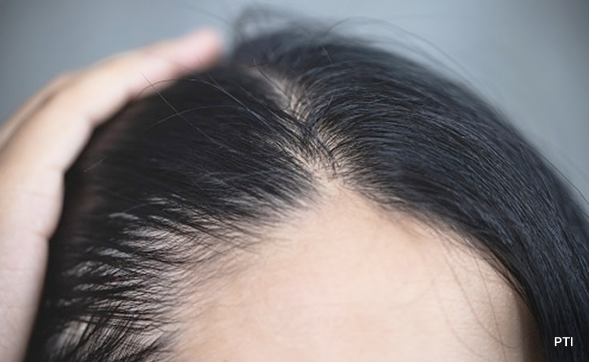 होम रेमेडी एक्सपर्ट से जानिए लंबे बाल पाने का रामबाण तरीका, घने और लंबे हो जाएंगे बाल
