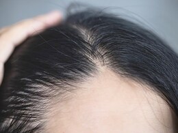 बालों का झड़ना रोकने में जादुई असर दिखाता है आंवला, बस इन 3 तरीकों से बालों में लगा लीजिए और खुद देखें कमाल बालों का झड़ना रोकने में जादुई असर दिखाता है आंवला, बस इन 3 तरीकों से बालों में लगा लीजिए और खुद देखें कमाल