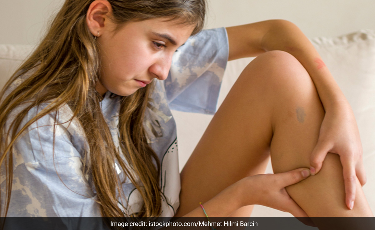 जवां उम्र में ही आपकी हड्डियां हो गई हैं बूढ़ी, चलने फिर में होने लगी है परेशानी तो हटा दें Diet से ये Food