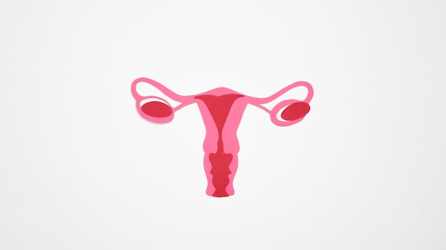 Uterine fibroids are non-cancerous growths that develop in or around the uterus