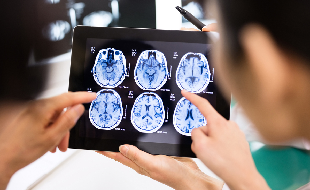 US Man's Deadly Brain Disease Linked To Covid-19