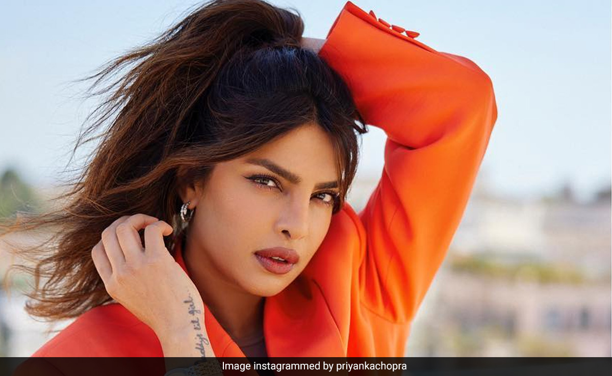 Priyanka Chopra Has A "Cool Scar And Good Story To Tell" After <i>Citadel</i> Injury
