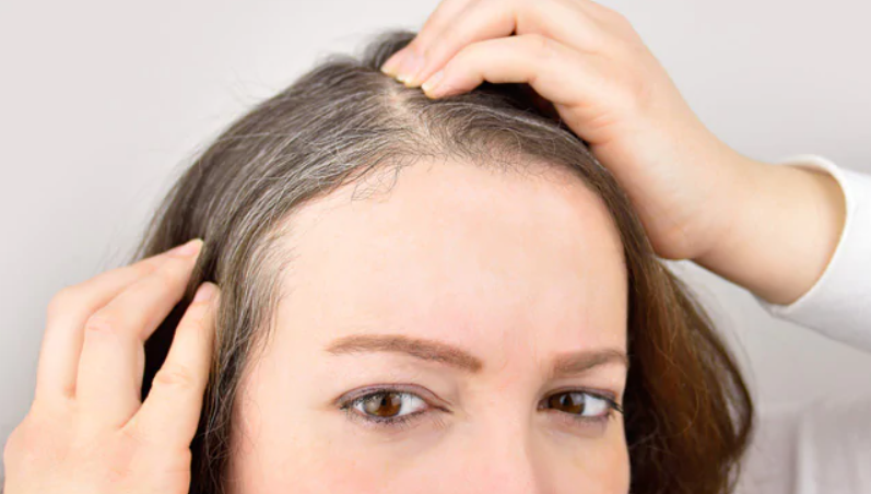 Premature Hair Greying: What's Triggering It And How To Reverse The Trend