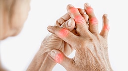 How Can High Uric Acid In The Body Affect Your Health?