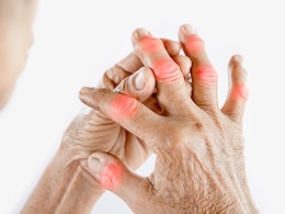 How Can High Uric Acid In The Body Affect Your Health?