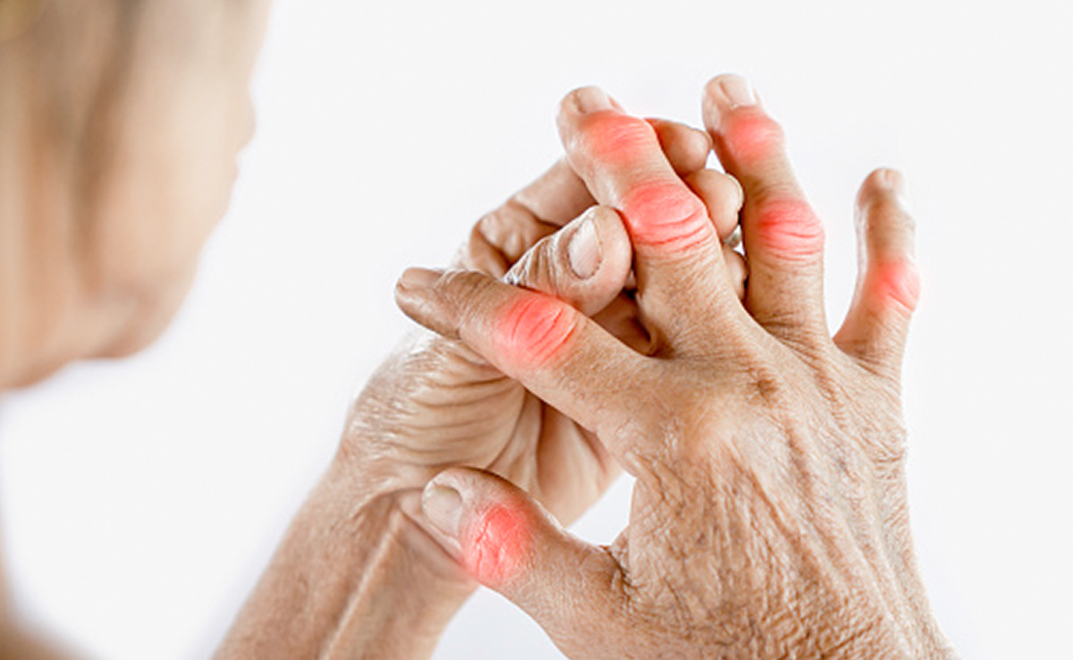 Uric Acid Effects: High uric acid can result in permanent joint damage if left untreated.