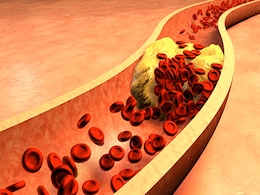 Managing High Cholesterol: हाई कोलेस्ट्रॉल को कंट्रोल करेंगे ये शानदार फूड कॉम्बिनेशन, जल्द कंट्रोल में आएगा हाई कोलेस्ट्रॉल Managing High Cholesterol: हाई कोलेस्ट्रॉल को कंट्रोल करेंगे ये शानदार फूड कॉम्बिनेशन, जल्द कंट्रोल में आएगा हाई कोलेस्ट्रॉल