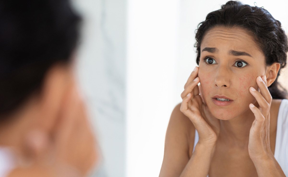 इन 4 नेचुरल चीजों से स्किन की बिगड़ी हालत को लीजिए सुधार, केमिकल प्रोडक्ट को हाथ लगाने की नहीं पड़ेगी जरूरत