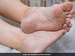 गंदे मैले पैर के पंजे हो जाएंगे चमकदार, इन आसान स्टेप्स को फॉलो कर घर पर कीजिए Pedicure, वीडियो देखिए यहां गंदे मैले पैर के पंजे हो जाएंगे चमकदार, इन आसान स्टेप्स को फॉलो कर घर पर कीजिए Pedicure, वीडियो देखिए यहां