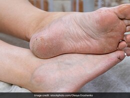 Pedicure at home : हाथ पैर की टैनिंग ऐसे करें दूर, चमक जाएंगे लेग्स Pedicure at home : हाथ पैर की टैनिंग ऐसे करें दूर, चमक जाएंगे लेग्स