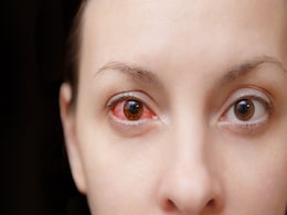 Eye Care: गर्मियों में सबसे आम हैं ये 4 आई प्रोब्लम्स, इन बातों का नहीं रखा ख्याल तो आंखें हो सकती हैं बीमार Eye Care: गर्मियों में सबसे आम हैं ये 4 आई प्रोब्लम्स, इन बातों का नहीं रखा ख्याल तो आंखें हो सकती हैं बीमार