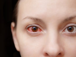 How To Treat Eye Burning: गर्मियों में आंखों की जलन को तुरंत शांत करने के लिए अपनाएं ये असरदार घरेलू उपाय How To Treat Eye Burning: गर्मियों में आंखों की जलन को तुरंत शांत करने के लिए अपनाएं ये असरदार घरेलू उपाय