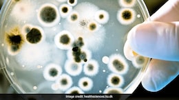 High Levels Of Antibiotic Resistant Superbugs In Delhi Air Posing Public Health Risks: Study