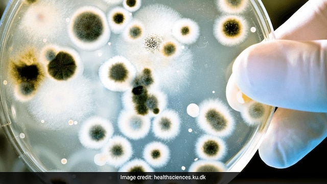 High Levels Of Antibiotic Resistant Superbugs In Delhi Air Posing Public Health Risks: Study