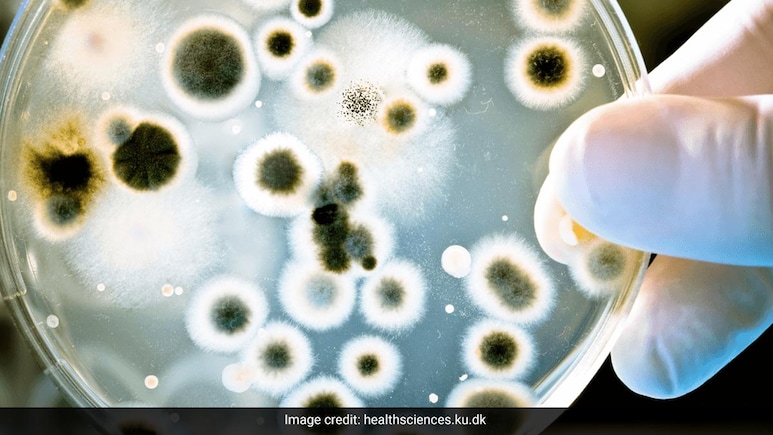 High Levels Of Antibiotic Resistant Superbugs In Delhi Air Posing Public Health Risks: Study