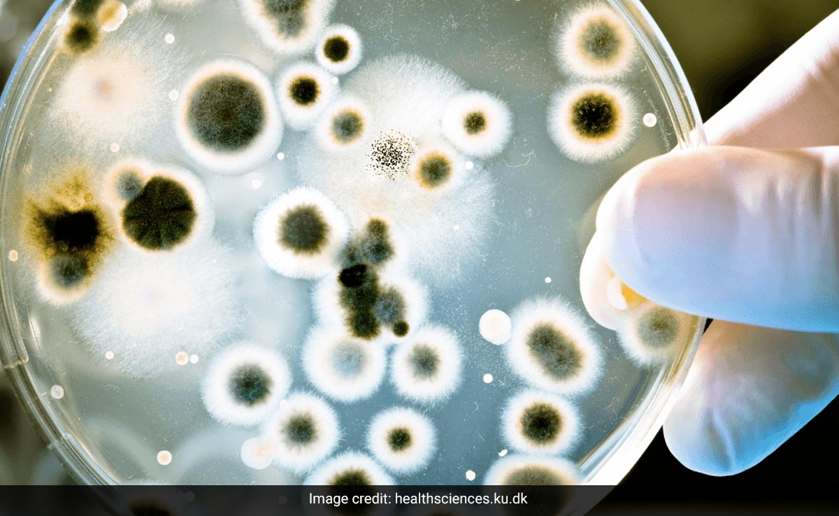 High Levels Of Antibiotic Resistant Superbugs In Delhi Air Posing Public Health Risks: Study
