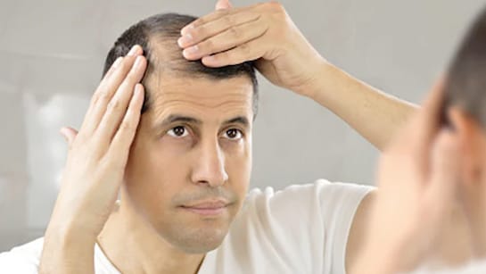 डैंड्रफ और टूटते बालों से हो गए हैं परेशान, तो आज से ही अपनाएं ये टिप्स, पाएं लंबे, घने और काले बाल डैंड्रफ और टूटते बालों से हो गए हैं परेशान, तो आज से ही अपनाएं ये टिप्स, पाएं लंबे, घने और काले बाल