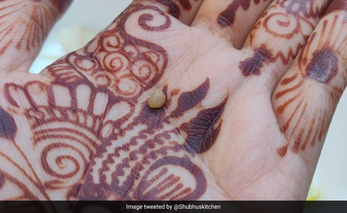 "Stones In Food": Woman Shares Pic Of Meal Served At Jaipur Airport Lounge. Their Reply