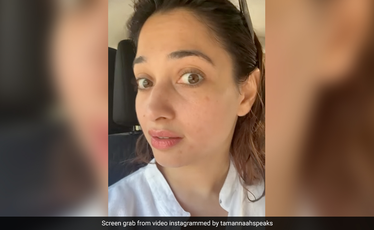 <i>Baahubali</i> Star Tamannaah's No-Filter Post For Bad Skin Days: "It Happens To Everyone"