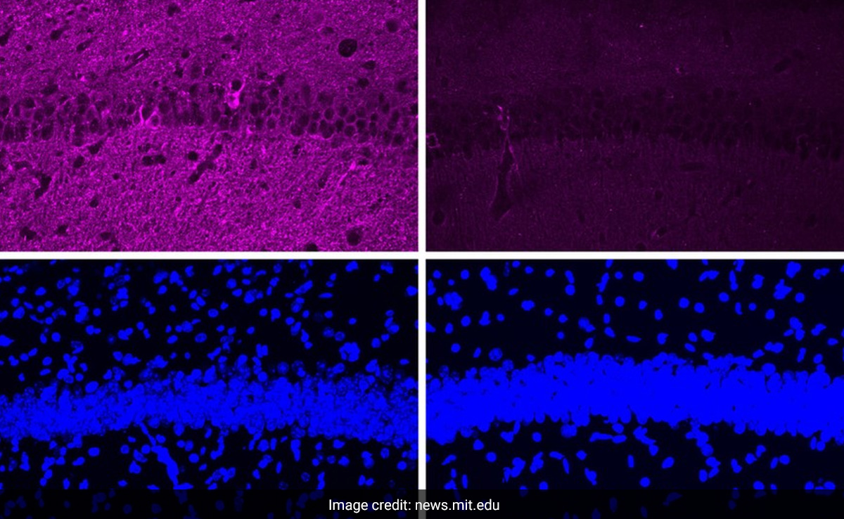 MIT Scientists Unlock A Major Breakthrough In Battle To Reverse Alzheimer's Disease