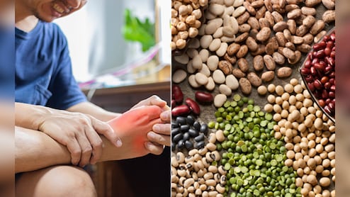 Uric Acid Treatment: युरिक अ‍ॅसिड नियंत्रणात ठेवण्यासाठी काय खावे, काय टाळावे; वाचा संपूर्ण यादी