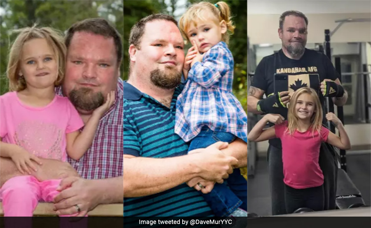 Canadian Man Chronicles His Weight Loss Journey. It Started After A Conversation With Daughter